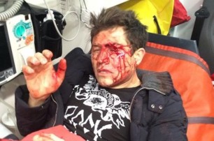 В Киеве трое неизвестных избили телеведущего Андрея Джеджулу