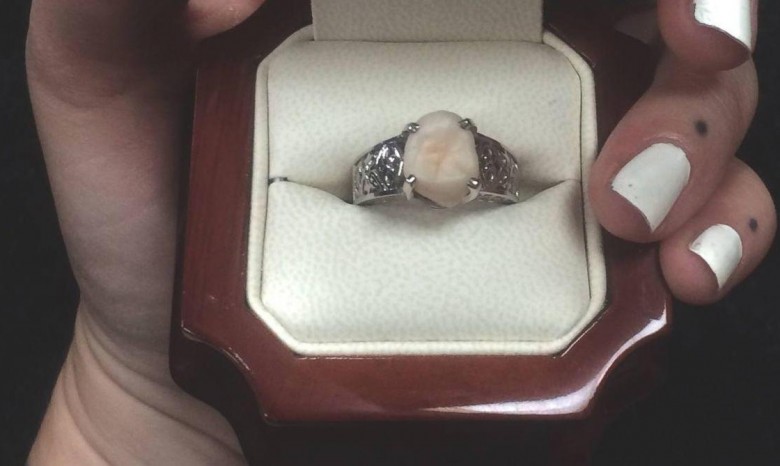 Парень подарил девушке кольцо со своим зубом мудрости вместо алмаза