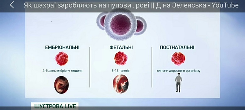 Компании Мартыненко и Сивковича хранят пуповинную кровь в гаражах – журналистское расследование Эспрессо TV