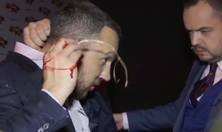 Радикал Мельничук сломал нос нардепу Линько после прямого эфира