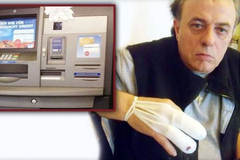 В Германии банкомат переломал пальцы клиенту