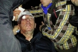"Беркут" разбил Луценко голову, его увезла "скорая"