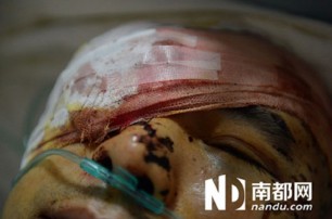 В Китае борца с коррупцией лишили глаза и двух пальцев
