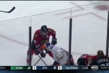 Хоккеист НХЛ руками вырвал сломанные шайбой зубы