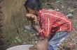 В Индии живет мальчик с руками больше, чем голова