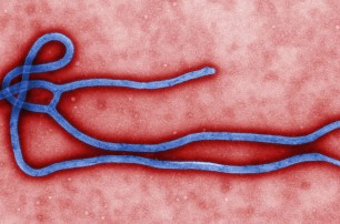 Киевские врачи утверждают, что держат ситуацию с Эбола под контролем
