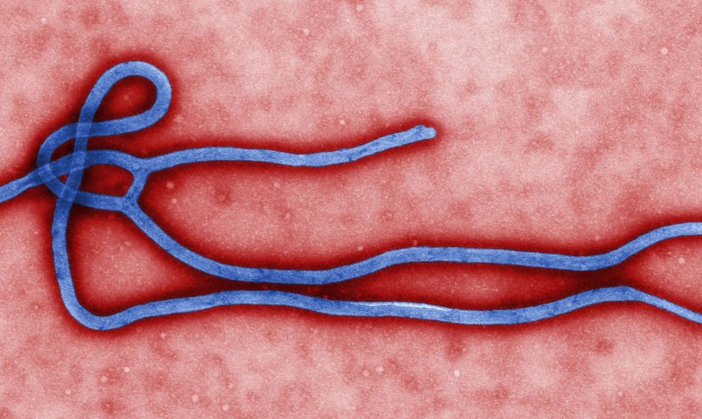 Киевские врачи утверждают, что держат ситуацию с Эбола под контролем