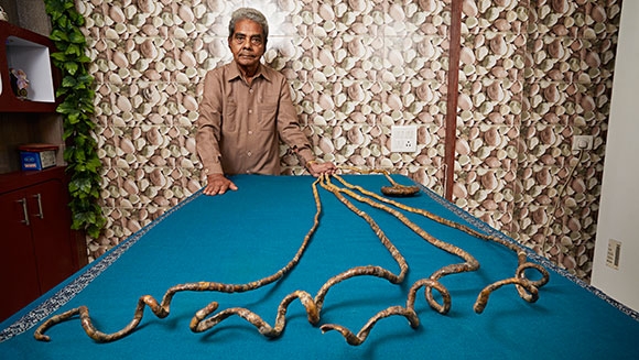 Пенсионер отрастил ногти общей длиной более 9 метров