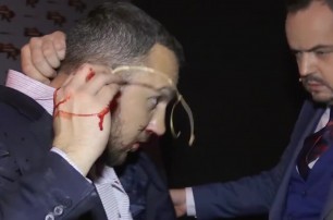 Радикал Мельничук сломал нос нардепу Линько после прямого эфира