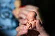 В Голосеевском монастыре психологи и врачи-гинекологи расскажут, как уговорить беременных не делать аборт