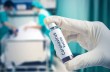 Борьба с эпидемией: как в мире ищут вакцину и лекарства против коронавируса