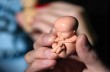 Митрополит УПЦ рассказал, допустим ли аборт, если врачи говорят о серьёзных патологиях у ребёнка