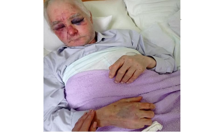 На Буковине сторонники ПЦУ жестоко избили 63-летнего прихожанина УПЦ